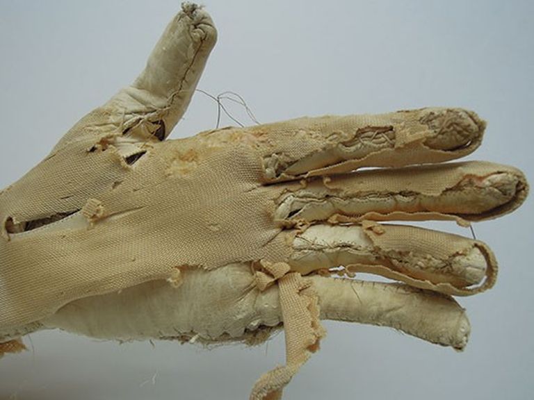 Mano e guanto prima del restauro